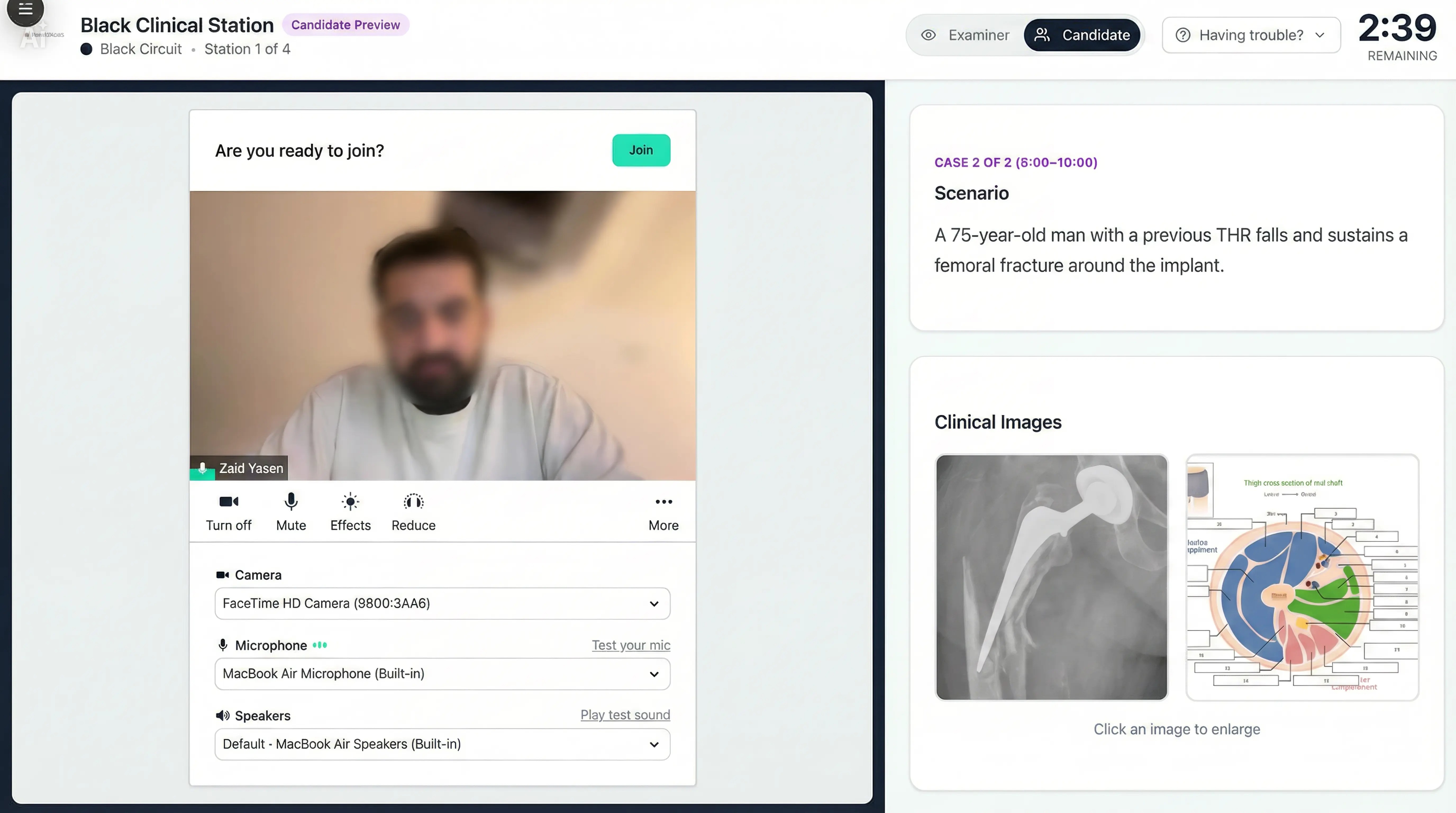 Candidate preview screen showing pre-join video, scenario text, and clinical images.